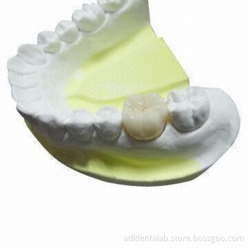 All Shade of Zirconia with Five-year Guarantee Against Breakage